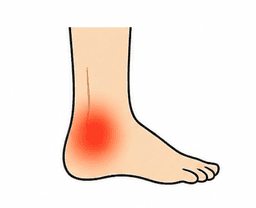 Ankle Pain