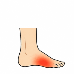 Foot Pain
