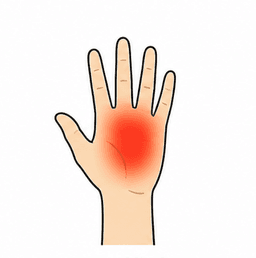 Hand Pain