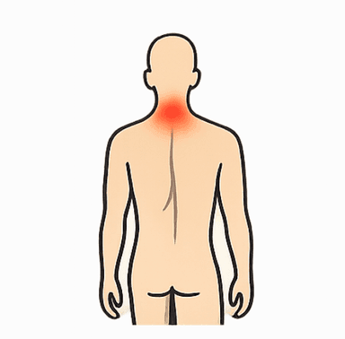 Neck Pain